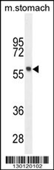 FEZF1 Antibody (N-term)