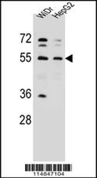 NARS Antibody (N-term)