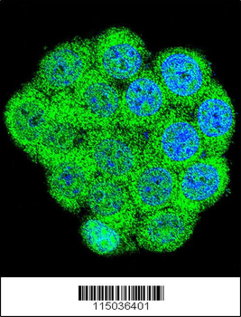 GAL Antibody (Center)