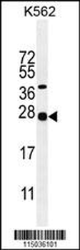 GAL Antibody (Center)