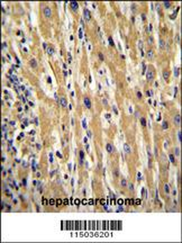 GAL Antibody (Center)