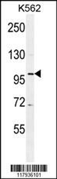 DDX27 Antibody (C-term)