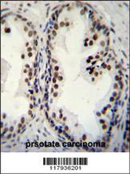 DDX27 Antibody (C-term)