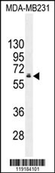 HNF1B Antibody (C-term)