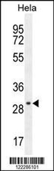 EMG1 Antibody (Center)