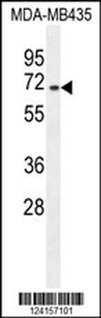 SFRS17A Antibody (Center)