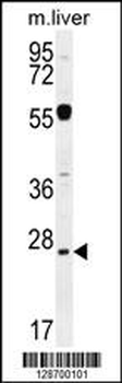 NPS3A Antibody (Center)