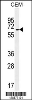 UNCX Antibody (C-term)