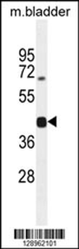 SH2D5 Antibody (Center)