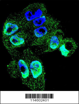 TIMP1 Antibody (C-term)