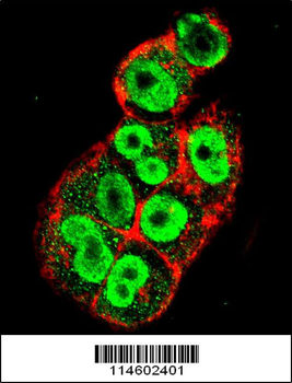 TIMP1 Antibody (C-term)