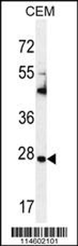 TIMP1 Antibody (C-term)