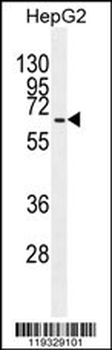 GAD1 Antibody (C-term)