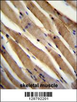 USP50 Antibody (Center)