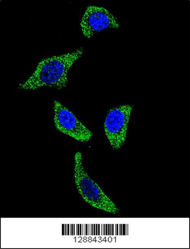 TNFRSF1A Antibody (N-term)