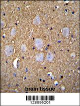 CAMSAP1 Antibody (N-term)