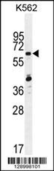 ZNF619 Antibody (N-term)