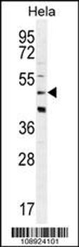 CRFR2D Antibody