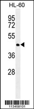NR6A1 Antibody (N-term)