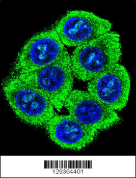 PATL2 Antibody (Center)