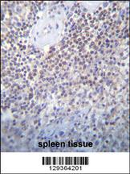 PATL2 Antibody (Center)