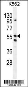 LRIT1 Antibody (C-term)