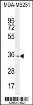 OR10Z1 Antibody (C-term)