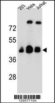 OR4C13 Antibody (N-term)