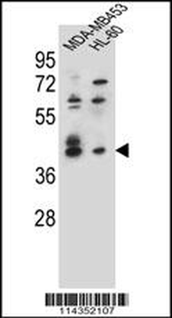 SOX3 Antibody (Center)