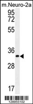 ZC3H8 Antibody (N-term)