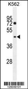 PM20D2 Antibody (C-term)