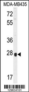OR8B4 Antibody (C-term)