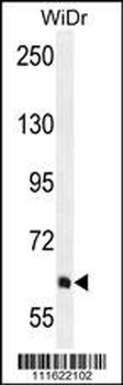 PIK3R5 Antibody (C-term)