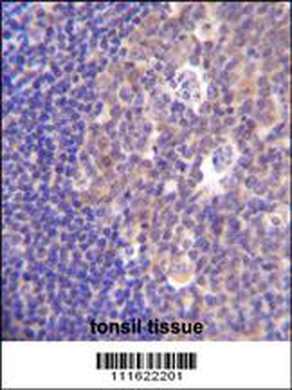 PIK3R5 Antibody (C-term)