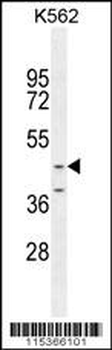 OC90 Antibody (Center)