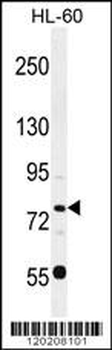 POU2F1 Antibody (Center)