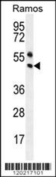 PAX5 Antibody (Center)
