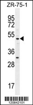 MEF2D Antibody (N-term)