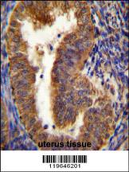 NIX Antibody (Center)