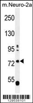 LRWD1 Antibody (N-term)