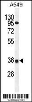 PRR19 Antibody (Center)