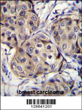 CBLN2 Antibody (C-term)