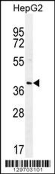 RNF215 Antibody (C-term)