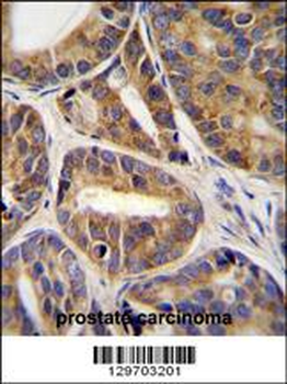 RNF215 Antibody (C-term)