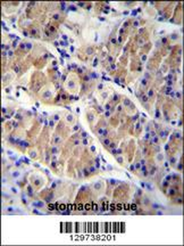 LRRC38 Antibody (C-term)