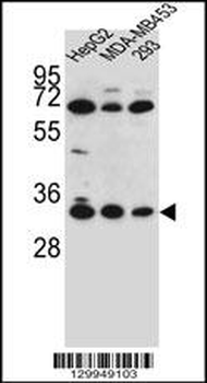 OR2T3 Antibody (C-term)