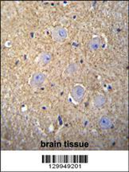 OR2T3 Antibody (C-term)