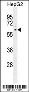 PPARD Antibody (C-term)