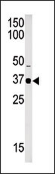SET7 Antibody (C-term)