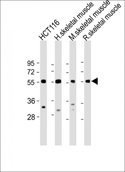TRIM72 Antibody (C-term)